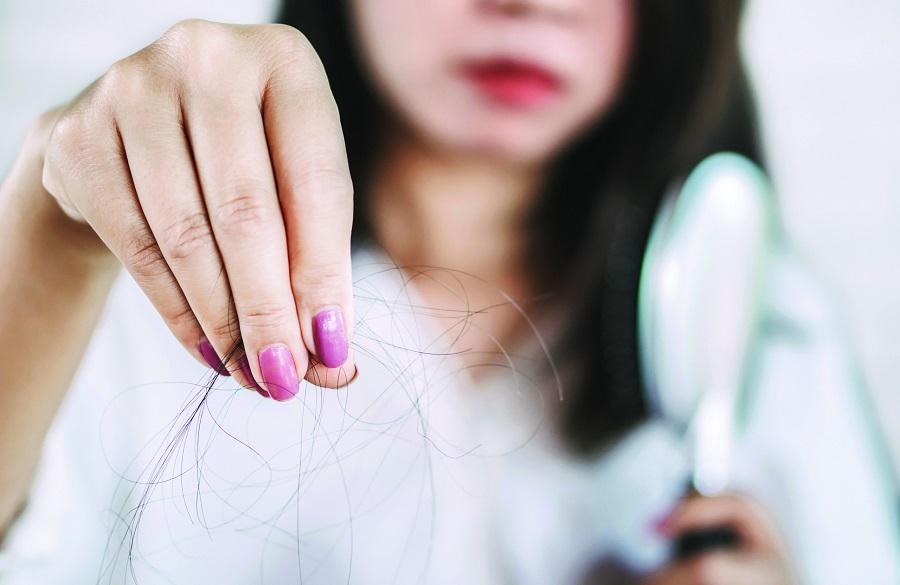 جلوگیری از ریزش مو